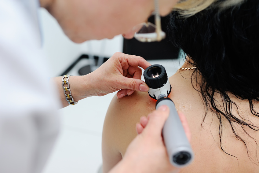 Konsultacja-dermatologiczna Konsultacja dermatologiczna