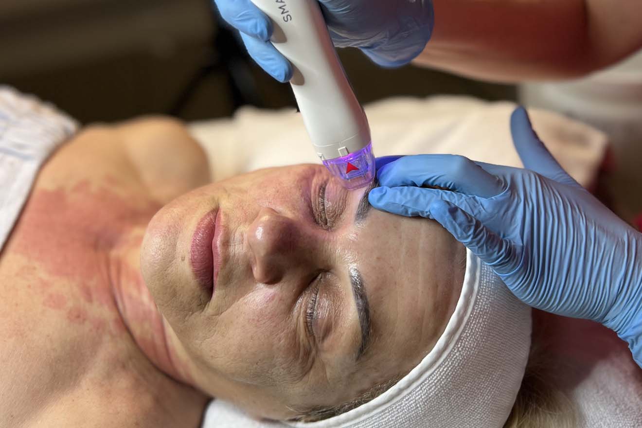 Beauty Center Medial Wellness Radiofrekwencja